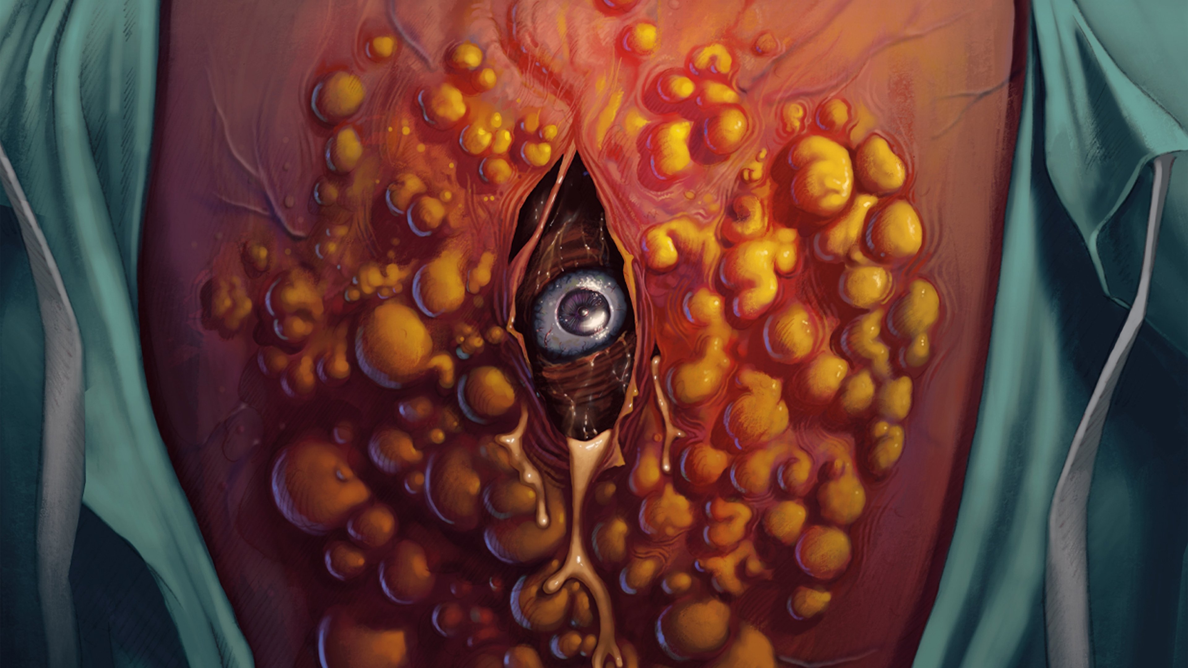 Cyst Background