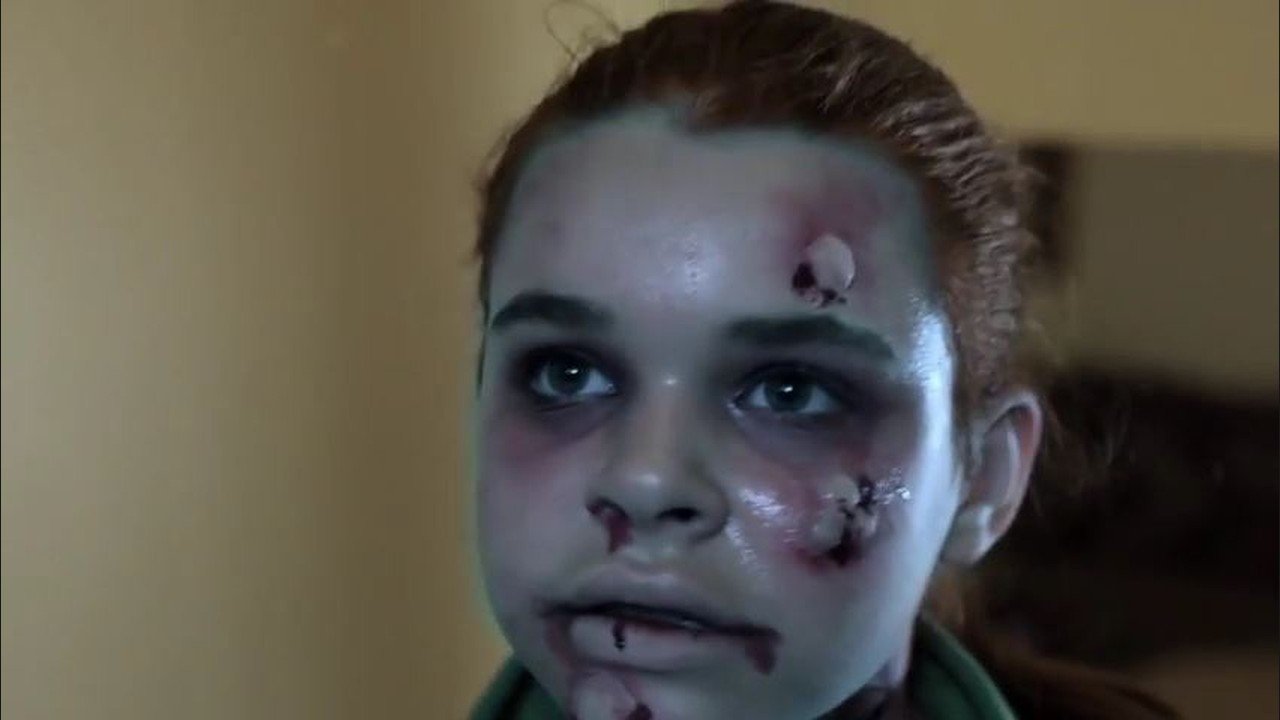 E19 Virus Background