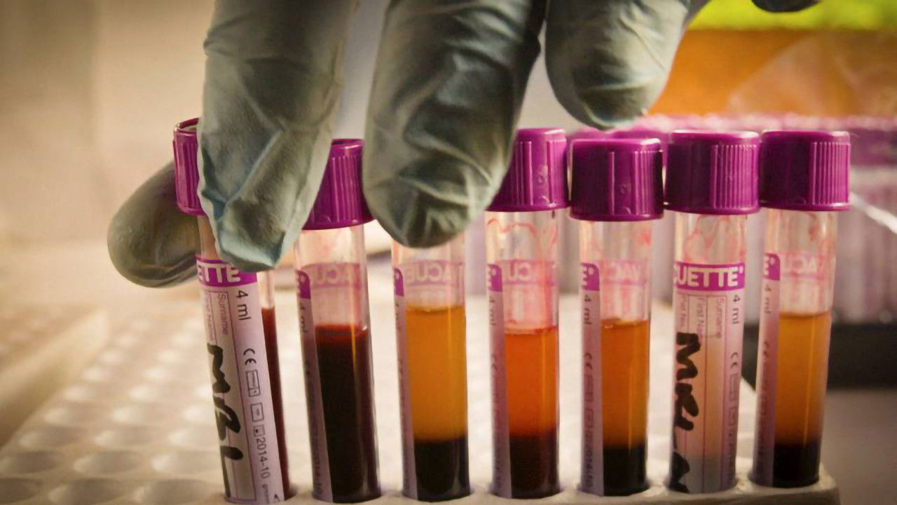 The Bloody Truth Background