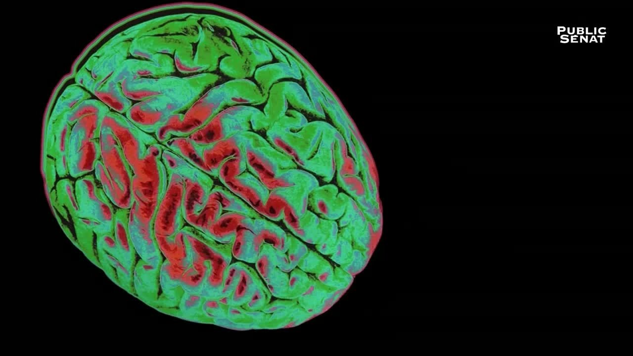 Le pouvoir nuit-il gravement au cerveau ? Background